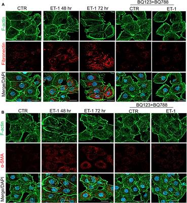 Ovarian Cancer-Driven Mesothelial-to-Mesenchymal Transition is Triggered by the Endothelin-1/β-arr1 Axis